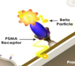Lu_PSMA